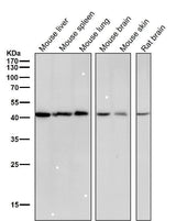 Anti-CABP Rabbit Monoclonal Antibody Boster Bio