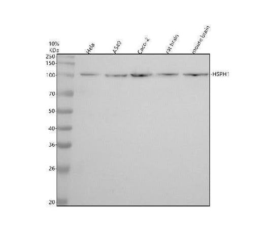 Anti-Hsp105 Rabbit Monoclonal Antibody Boster Bio