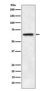 Anti-ABCE1 Rabbit Monoclonal Antibody Boster Bio