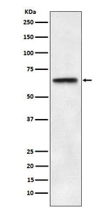 Anti-ABCE1 Rabbit Monoclonal Antibody Boster Bio