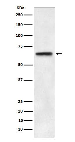 Anti-ABCE1 Rabbit Monoclonal Antibody Boster Bio