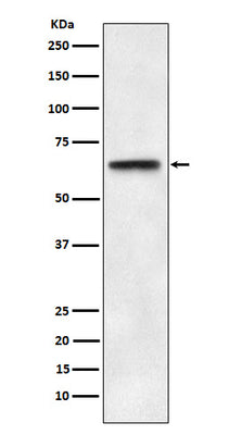 Anti-ABCE1 Rabbit Monoclonal Antibody Boster Bio