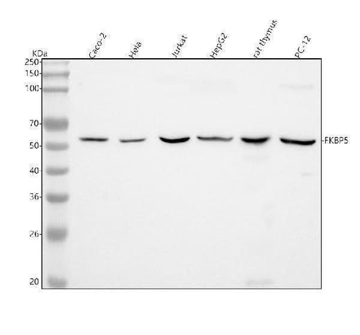 Anti-FKBP51 Monoclonal Antibody Boster Bio