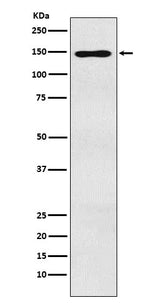 Anti-MYBBP1A Monoclonal Antibody Boster Bio