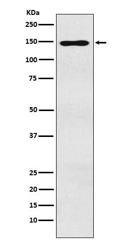 Anti-MYBBP1A Monoclonal Antibody Boster Bio