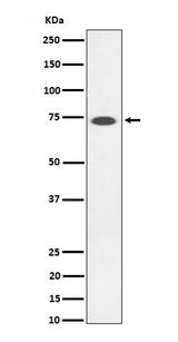 Anti-SSTR3 Rabbit Monoclonal Antibody Boster Bio