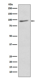Anti-EIF2C3 AGO3 Rabbit Monoclonal Antibody Boster Bio