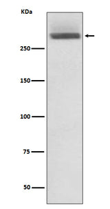 Anti-LAMA3/Laminin 5 Rabbit Monoclonal Antibody Boster Bio