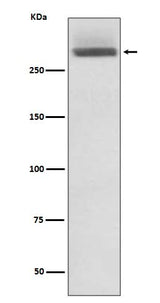 Anti-LAMA3/Laminin 5 Rabbit Monoclonal Antibody Boster Bio