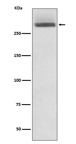 Anti-LAMA3/Laminin 5 Rabbit Monoclonal Antibody Boster Bio
