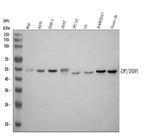 Anti-DP1 Rabbit Monoclonal Antibody Boster Bio