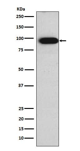 Anti-Villin VIL1 Monoclonal Antibody Boster Bio