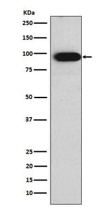 Anti-Villin VIL1 Monoclonal Antibody Boster Bio
