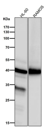 Anti-NCF4 Rabbit Monoclonal Antibody Boster Bio