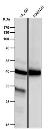 Anti-NCF4 Rabbit Monoclonal Antibody Boster Bio