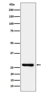 Anti-DcR1 / CD263 Rabbit Monoclonal Antibody Boster Bio