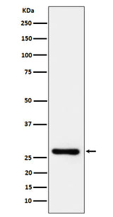 Anti-DcR1 / CD263 Rabbit Monoclonal Antibody Boster Bio