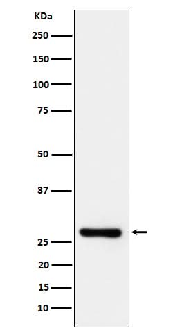 Anti-DcR1 / CD263 Rabbit Monoclonal Antibody Boster Bio