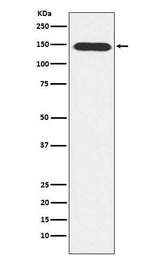 Anti-PLCB3 Rabbit Monoclonal Antibody Boster Bio