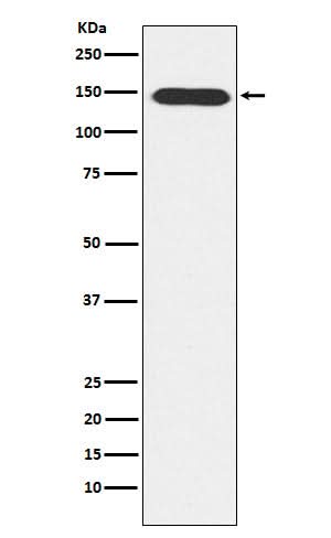 Anti-PLCB3 Rabbit Monoclonal Antibody Boster Bio