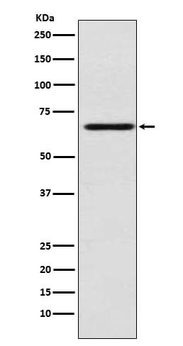 Anti-MADCAM1 Rabbit Monoclonal Antibody Boster Bio