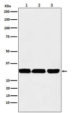 Anti-p53 DINP1 Rabbit Monoclonal Antibody Boster Bio