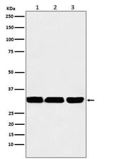 Anti-p53 DINP1 Rabbit Monoclonal Antibody Boster Bio
