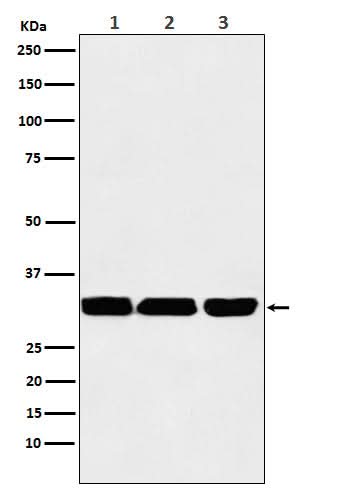 Anti-p53 DINP1 Rabbit Monoclonal Antibody Boster Bio