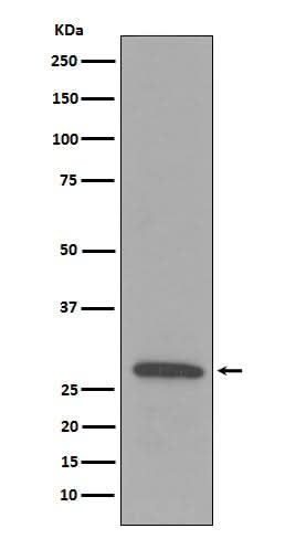 Anti-C1QB Rabbit Monoclonal Antibody Boster Bio