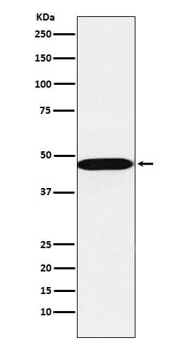 Anti-AHCY Rabbit Monoclonal Antibody Boster Bio