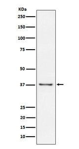 Anti-CD23 FCER2 Monoclonal Antibody Boster Bio