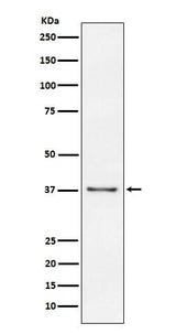 Anti-CD23 FCER2 Monoclonal Antibody Boster Bio