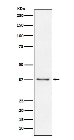 Anti-CD23 FCER2 Monoclonal Antibody Boster Bio