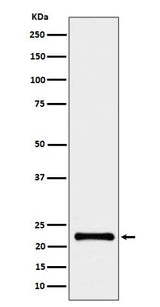 Anti-CRCP Rabbit Monoclonal Antibody Boster Bio