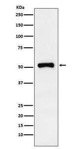 Anti-Retinoic Acid Receptor gamma Rabbit Monoclonal Antibody Boster Bio
