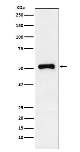 Anti-Retinoic Acid Receptor gamma Rabbit Monoclonal Antibody Boster Bio