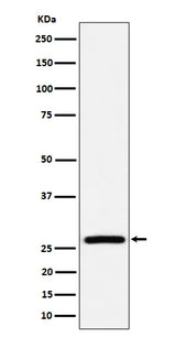 Anti-AK2 Rabbit Monoclonal Antibody Boster Bio