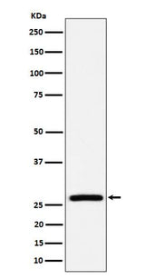 Anti-AK2 Rabbit Monoclonal Antibody Boster Bio