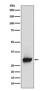 Anti-Calretinin Monoclonal Antibody Boster Bio