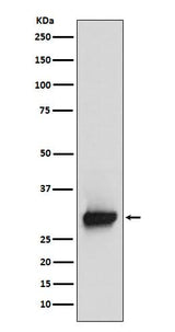 Anti-Calretinin Monoclonal Antibody Boster Bio