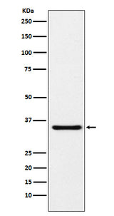 Anti-MDH1 Rabbit Monoclonal Antibody Boster Bio