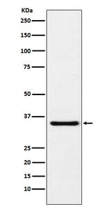 Anti-MDH1 Rabbit Monoclonal Antibody Boster Bio