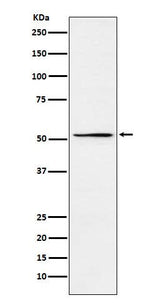 Anti-MEIS2 Rabbit Monoclonal Antibody Boster Bio