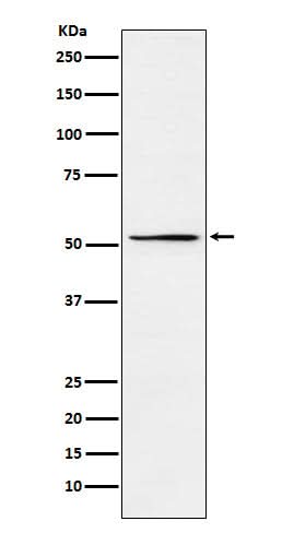 Anti-MEIS2 Rabbit Monoclonal Antibody Boster Bio
