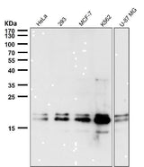Anti-DUT Rabbit Monoclonal Antibody Boster Bio