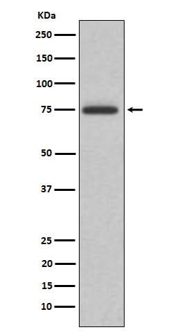 Anti-ABI2 Rabbit Monoclonal Antibody Boster Bio