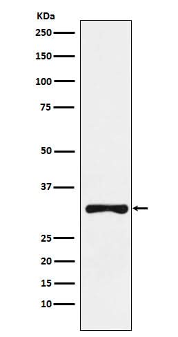 Anti-RYBP Rabbit Monoclonal Antibody Boster Bio