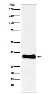 Anti-Monoacylglycerol Lipase Rabbit Monoclonal Antibody Boster Bio