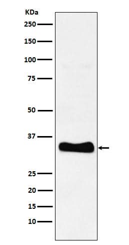 Anti-Monoacylglycerol Lipase Rabbit Monoclonal Antibody Boster Bio