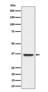 Anti-ULBP1 Rabbit Monoclonal Antibody Boster Bio